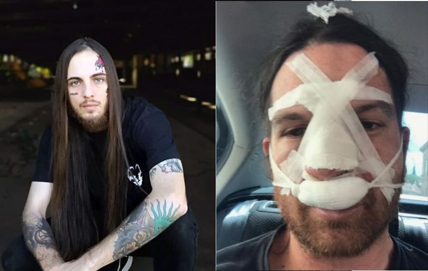 Read more about the article VULVODYNIA “απομάκρυναν τον τραγουδιστή Duncan Bentley λόγω σοβαρού περιστατικού βίας στο Drummer”